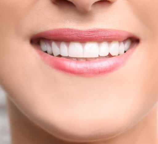 nose-to-chin closeup of a woman smiling with perfect teeth